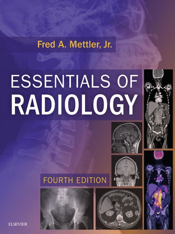 Produktbild: Essentials of Radiology E-Book