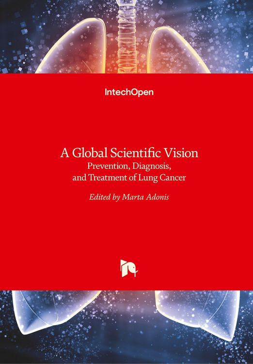 Produktbild: A Global Scientific VisionPrevention, Diagnosis, and Treatment of Lung Cancer