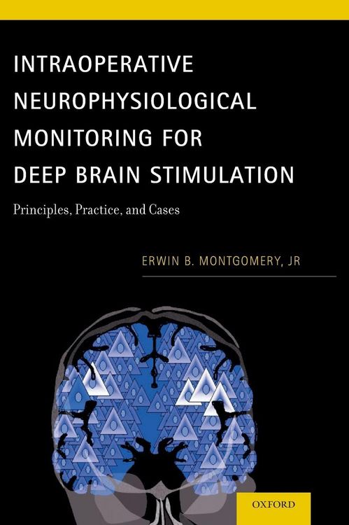 Produktbild: Intraoperative Neurophysiological Monitoring for Deep Brain Stimulation