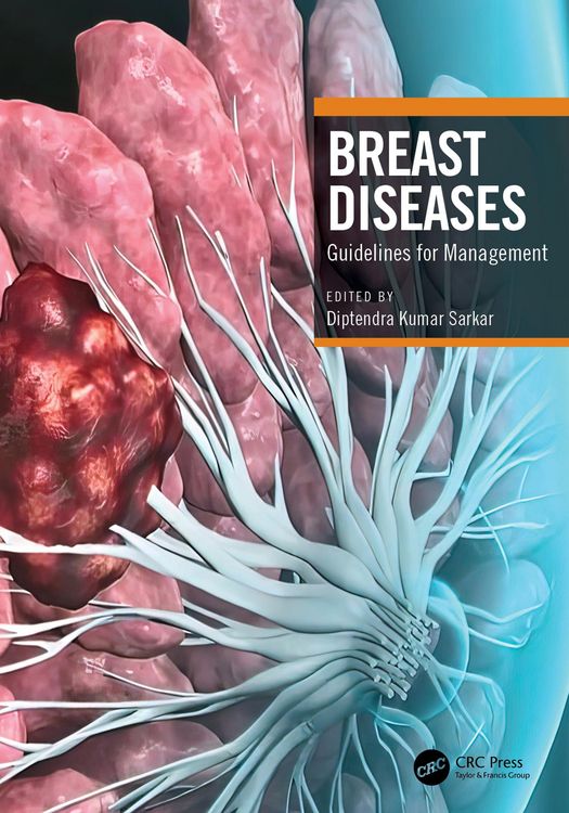 Produktbild: Breast Diseases