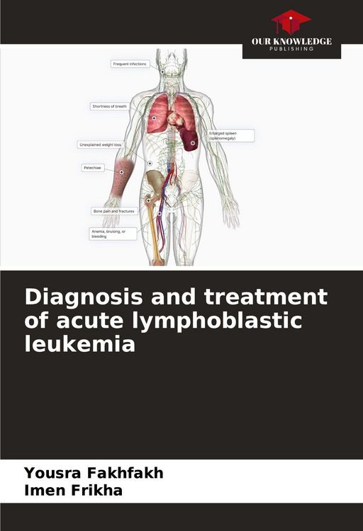 Produktbild: Diagnosis and treatment of acute lymphoblastic leukemia
