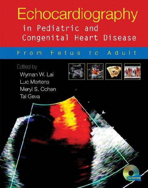 Produktbild: Echocardiography in Pediatric and Congenital Heart Disease
