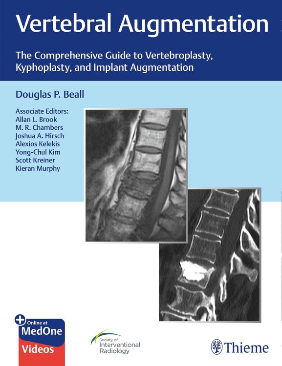 Produktbild: Vertebral Augmentation