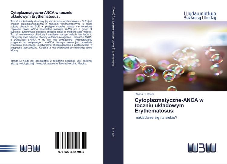 Produktbild: Cytoplazmatyczne-ANCA w toczniu uk&iquest;adowym Erythematosus: