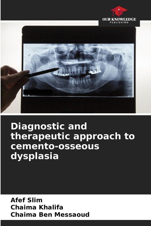 Produktbild: Diagnostic and therapeutic approach to cemento-osseous dysplasia