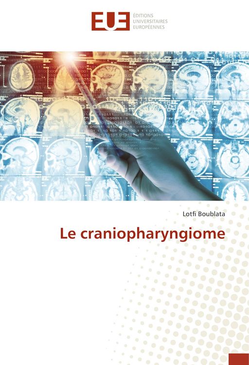 Produktbild: Le craniopharyngiome