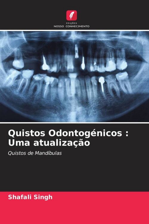 Produktbild: Quistos Odontog&eacute;nicos : Uma atualiza&ccedil;&atilde;o