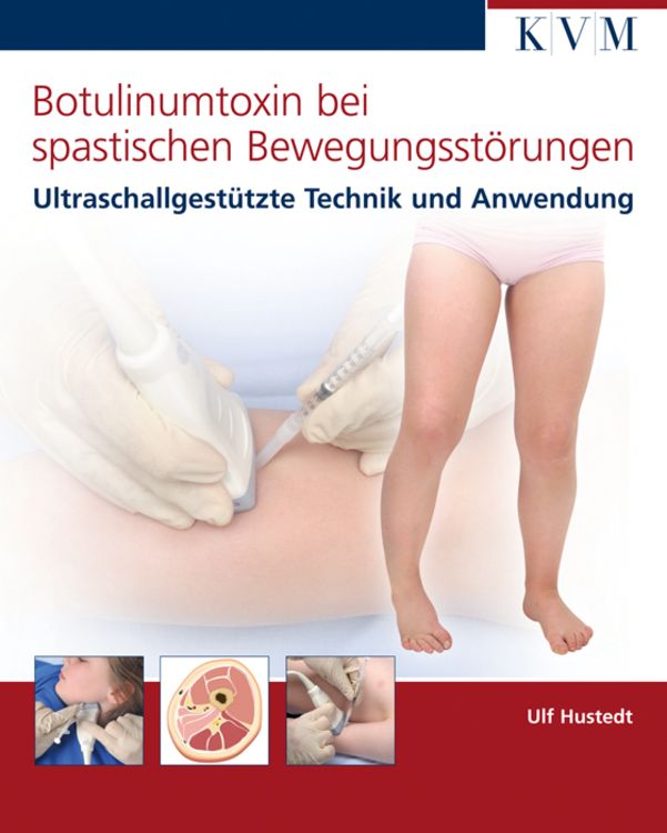 Produktbild: Botulinumtoxin bei spastischen Bewegungsst&ouml;rungen