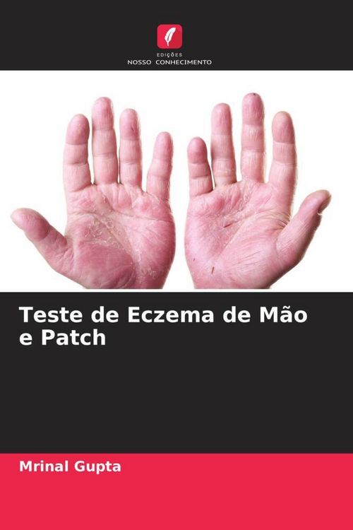 Produktbild: Teste de Eczema de M&atilde;o e Patch