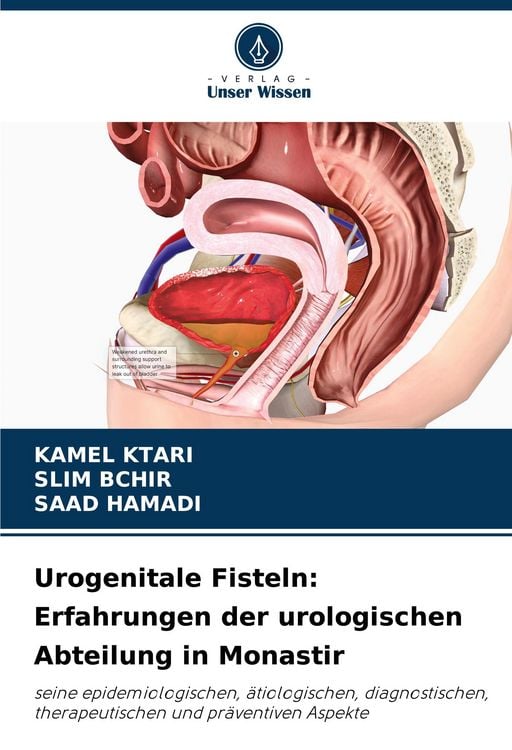 Produktbild: Urogenitale Fisteln: Erfahrungen der urologischen Abteilung in Monastir