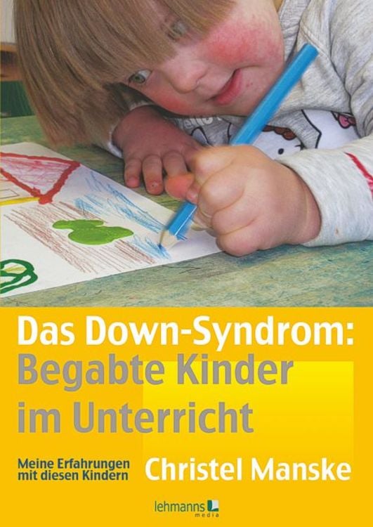 Produktbild: Das Down-Syndrom – Begabte Kinder im Unterricht
