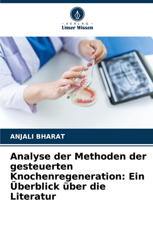 Produktbild: Analyse der Methoden der gesteuerten Knochenregeneration: Ein &Uuml;berblick &uuml;ber die Literatur