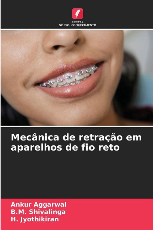 Produktbild: Mec&acirc;nica de retra&ccedil;&atilde;o em aparelhos de fio reto