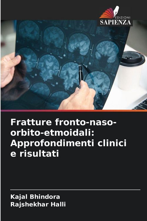 Produktbild: Fratture fronto-naso-orbito-etmoidali: Approfondimenti clinici e risultati