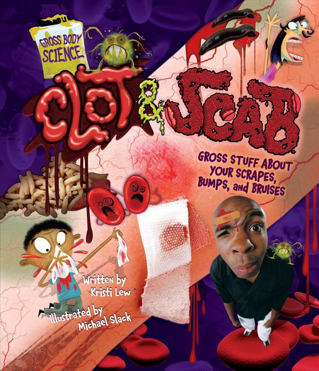 Produktbild: Clot & Scab