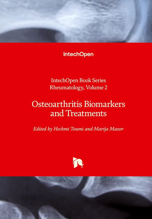 Produktbild: Osteoarthritis Biomarkers and Treatments