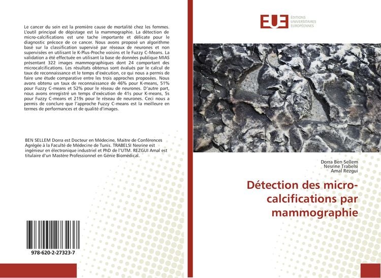 Produktbild: D&eacute;tection des micro-calcifications par mammographie