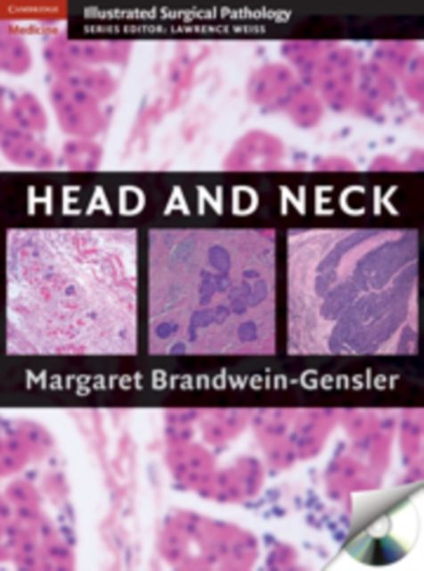 Produktbild: Head and Neck