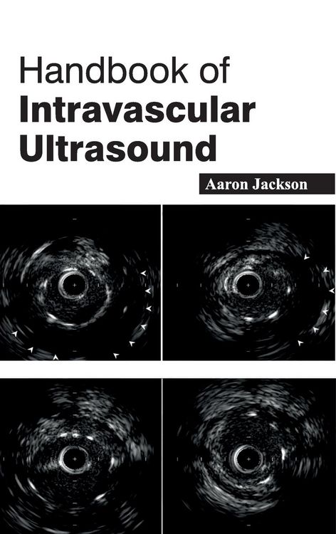 Produktbild: Handbook of Intravascular Ultrasound