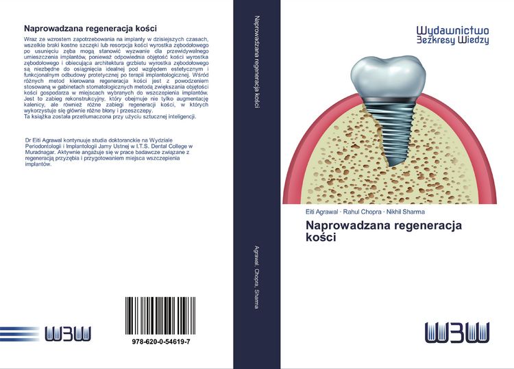 Produktbild: Naprowadzana regeneracja ko&iquest;ci