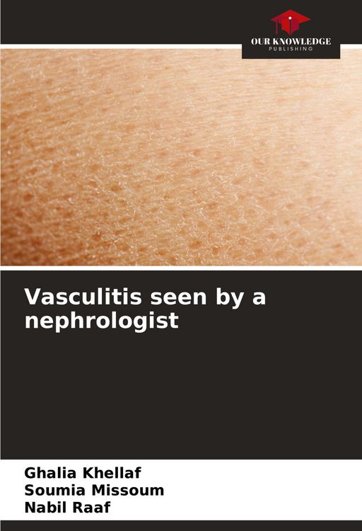 Produktbild: Vasculitis seen by a nephrologist