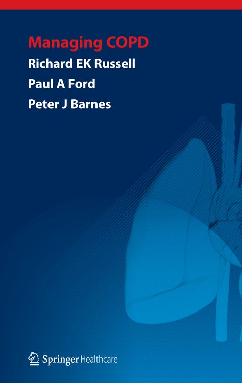 Produktbild: Managing COPD