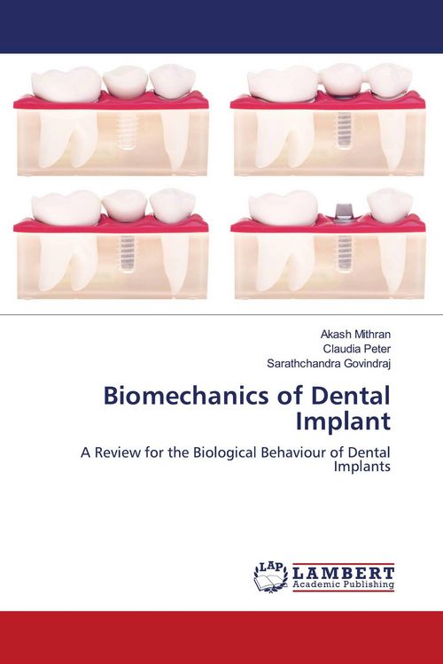 Produktbild: Biomechanics of Dental Implant