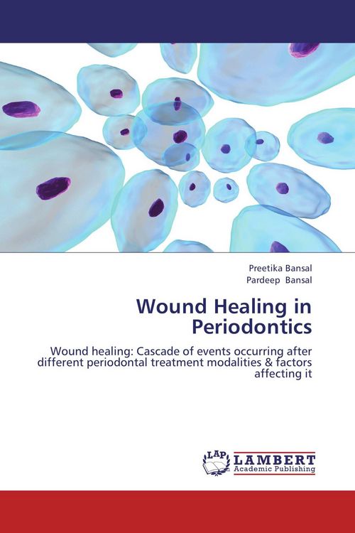 Produktbild: Wound Healing in Periodontics