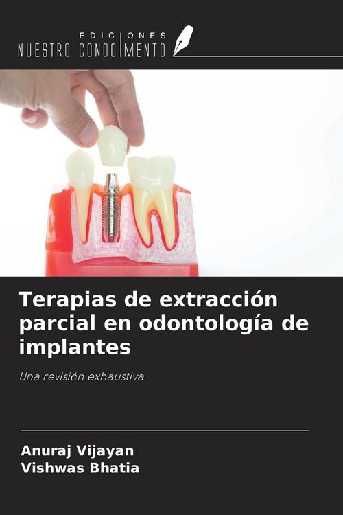 Produktbild: Terapias de extracci&oacute;n parcial en odontolog&iacute;a de implantes