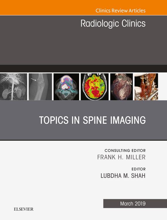 Produktbild: Topics in Spine Imaging, An Issue of Radiologic Clinics of North America