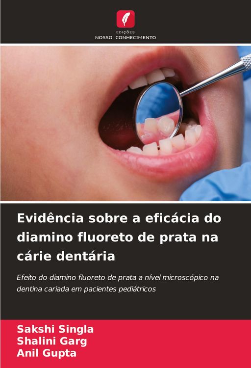 Produktbild: Evid&ecirc;ncia sobre a efic&aacute;cia do diamino fluoreto de prata na c&aacute;rie dent&aacute;ria
