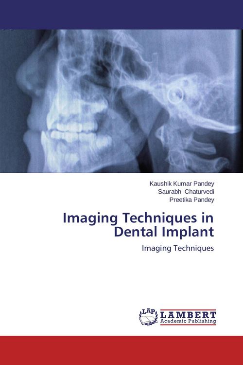 Produktbild: Imaging Techniques in Dental Implant