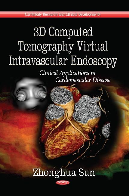Produktbild: Sun, Z: 3D Computed Tomography Virtual Intravascular Endosco