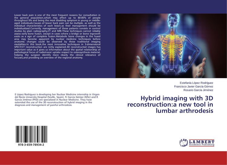 Produktbild: Hybrid imaging with 3D reconstruction:a new tool in lumbar arthrodesis