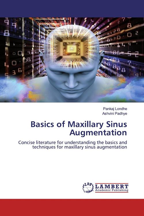 Produktbild: Basics of Maxillary Sinus Augmentation