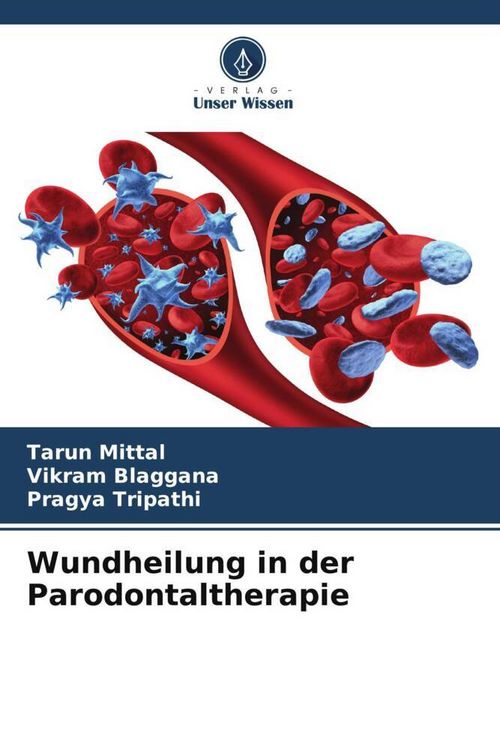 Produktbild: Wundheilung in der Parodontaltherapie