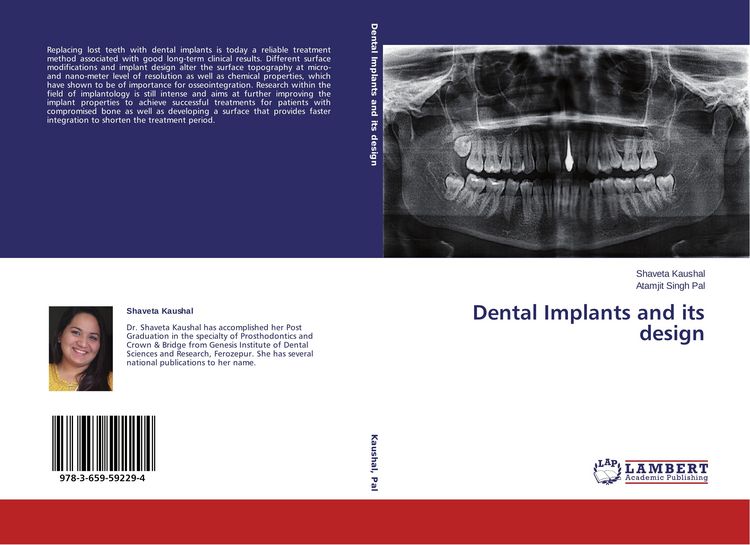 Produktbild: Dental Implants and its design