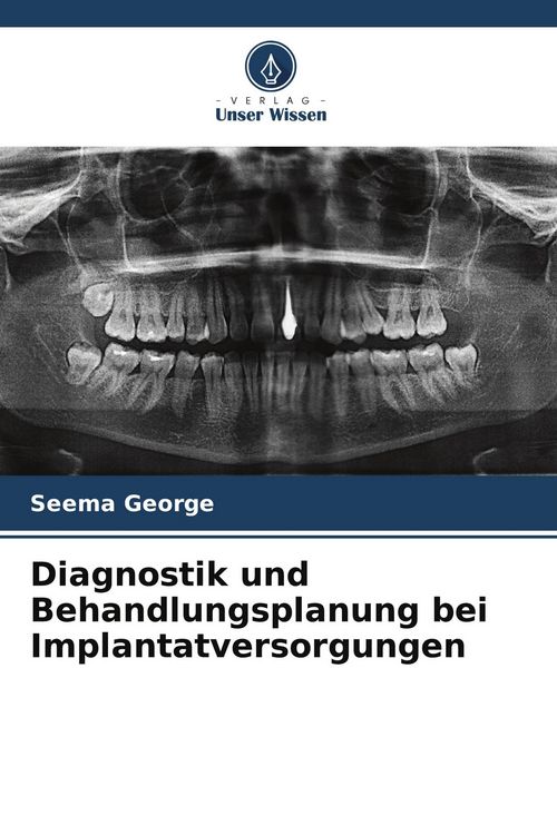 Produktbild: Diagnostik und Behandlungsplanung bei Implantatversorgungen