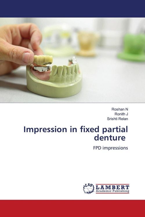 Produktbild: Impression in fixed partial denture