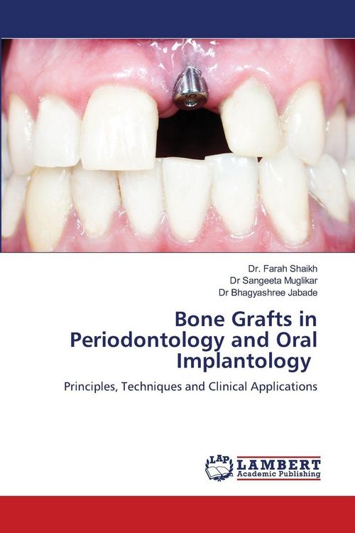 Produktbild: Bone Grafts in Periodontology and Oral Implantology