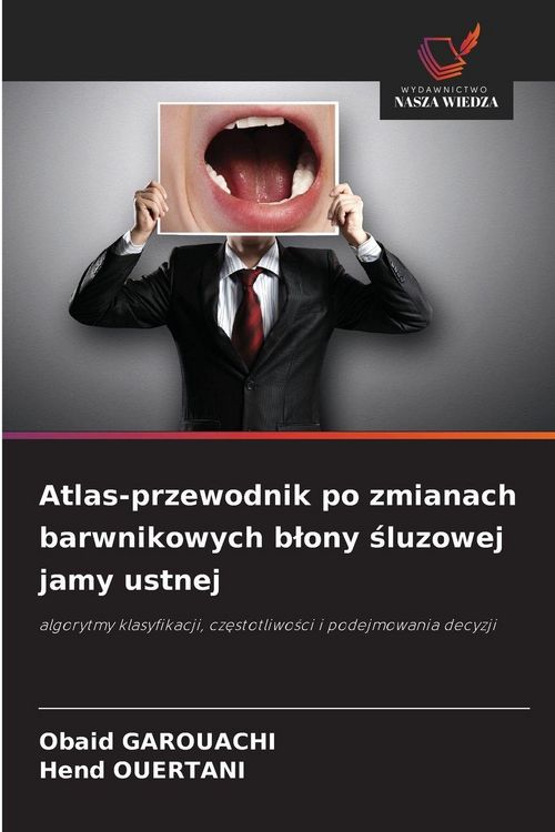 Produktbild: Atlas-przewodnik po zmianach barwnikowych b&iquest;ony &iquest;luzowej jamy ustnej