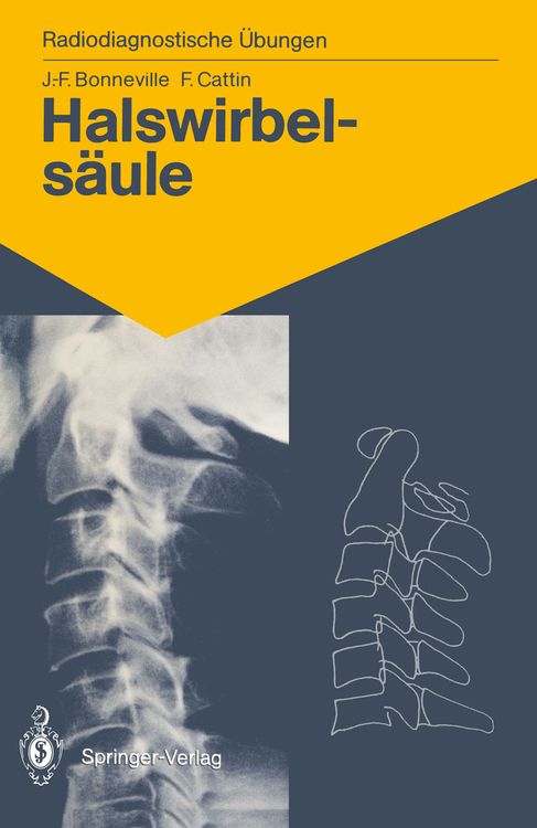 Produktbild: Halswirbels&auml;ule
