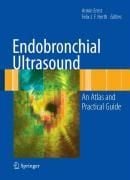 Produktbild: Endobronchial Ultrasound