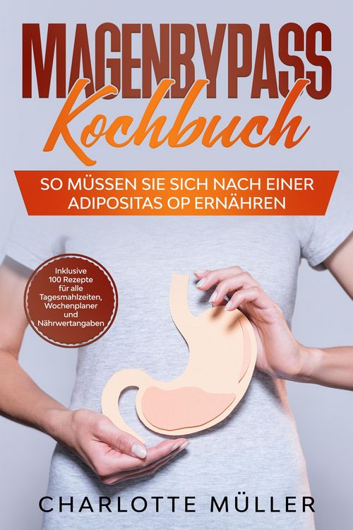 Produktbild: Magenbypass Kochbuch: So m&uuml;ssen Sie sich nach einer Adipositas OP ern&auml;hren - Inklusive 100 Rezepte f&uuml;r alle Tagesmahlzeiten, Wochenplaner und N&auml;hrwert