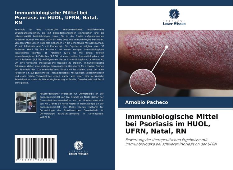 Produktbild: Immunbiologische Mittel bei Psoriasis im HUOL, UFRN, Natal, RN