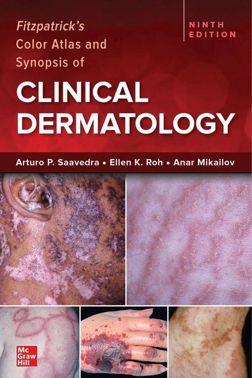Produktbild: Fitzpatrick's Color Atlas and Synopsis of Clinical Dermatology, Ninth Edition