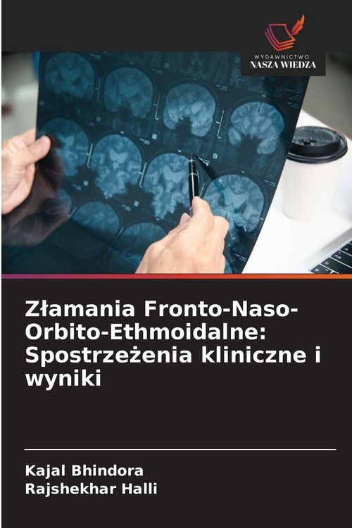 Produktbild: Z&iquest;amania Fronto-Naso-Orbito-Ethmoidalne: Spostrze&iquest;enia kliniczne i wyniki