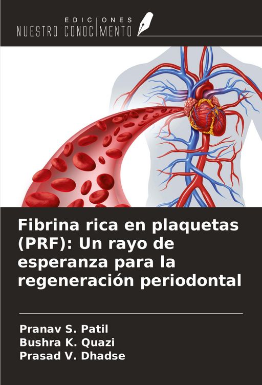 Produktbild: Fibrina rica en plaquetas (PRF): Un rayo de esperanza para la regeneraci&oacute;n periodontal