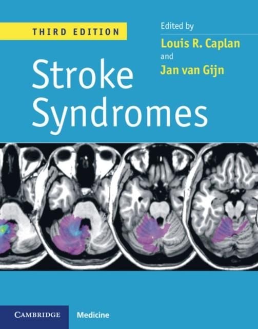 Produktbild: Stroke Syndromes, 3ed