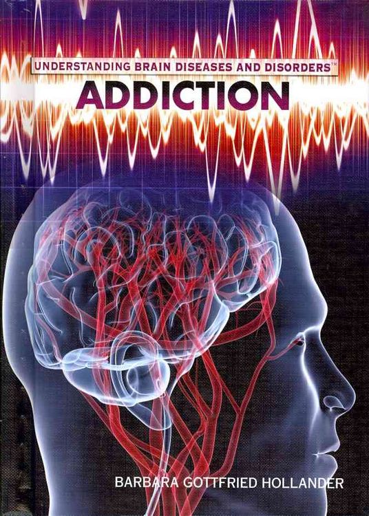 Produktbild: Understanding Brain Diseases and Disorders